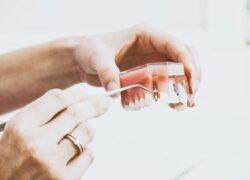 Hasznos tudnivalók az implantátumok kapcsán