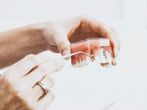 Hasznos tudnivalók az implantátumok kapcsán